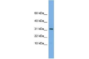 WB Suggested Anti-MRPS6 Antibody Titration: 0. (MRPS6 抗体  (C-Term))