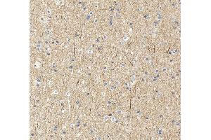 IHC analysis of UBE3A using anti-UBE3A antibody (ABIN7599562).