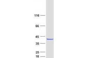 COQ9 Protein (Myc-DYKDDDDK Tag)