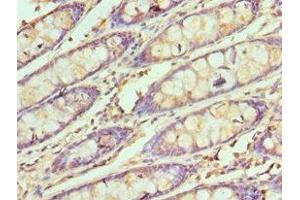 Immunohistochemistry (IHC) image for anti-SWI/SNF Related, Matrix Associated, Actin Dependent Regulator of Chromatin, Subfamily B, Member 1 (SMARCB1) (AA 86-385) antibody (ABIN7171070)