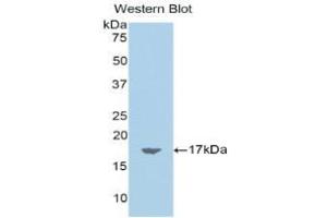 Western blot analysis of the recombinant protein. (Chemerin 抗体  (AA 25-152))