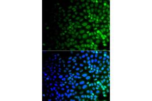 Immunofluorescence analysis of A549 cells using ULK4 antibody (ABIN5975557). (ULK4 抗体)