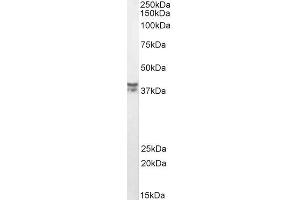 ABIN2613451 (0. (MSI2 抗体  (AA 33-43))