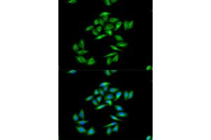 Immunofluorescence (IF) image for anti-Carnitine Palmitoyltransferase 1A (Liver) (CPT1A) antibody (ABIN1876495) (CPT1A 抗体)