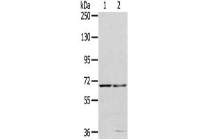 Gel: 6 % SDS-PAGE,Lysate: 40 μg,Lane 1-2: 293T cells, HepG2 cells,Primary antibody: ABIN7191487(MMP24 Antibody) at dilution 1/200 dilution,Secondary antibody: Goat anti rabbit IgG at 1/8000 dilution,Exposure time: 40 seconds (MMP24 抗体)