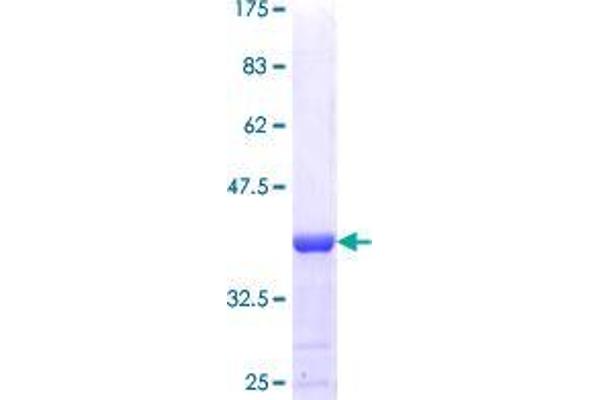 RBM17 Protein (AA 302-401) (GST tag)