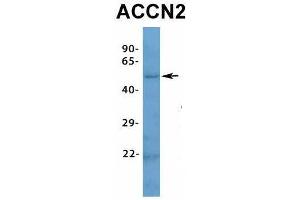 Host:  Rabbit  Target Name:  ACCN2  Sample Type:  Human Fetal Muscle  Antibody Dilution:  1. (ASIC1 抗体  (N-Term))