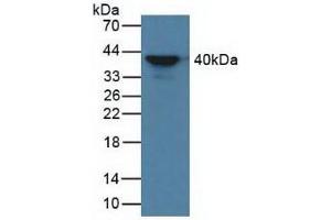 Detection of aZGP1 in Human Serum using Polyclonal Antibody to Alpha-2-Glycoprotein 1, Zinc Binding (aZGP1) (AZGP1 抗体  (AA 148-298))