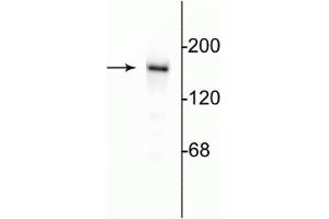 Western blot of 10 µg of rat hippocampal lysate showing specific immunolabeling of the ~180 kDa NR2B subunit of the NMDA receptor. (GRIN2B 抗体  (C-Term))