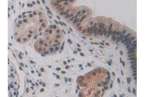 Used in DAB staining on fromalin fixed paraffin- embedded kidney tissue (NG2 抗体  (AA 1919-2258))