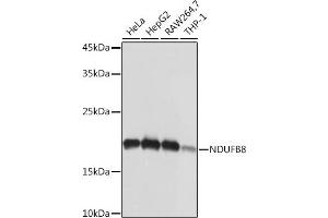 Western blot analysis of extracts of various cell lines, using NDUFB8 Rabbit mAb (ABIN7268813) at 1:1000 dilution.