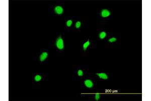 Immunofluorescence of monoclonal antibody to TBX6 on HeLa cell. (T-Box 6 抗体  (AA 191-299))