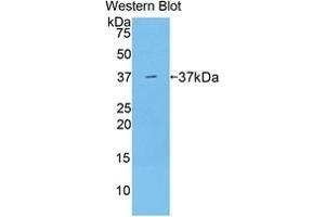 Detection of Recombinant ARG, Mouse using Polyclonal Antibody to Arginase (ARG) (ARG 抗体  (AA 1-323))