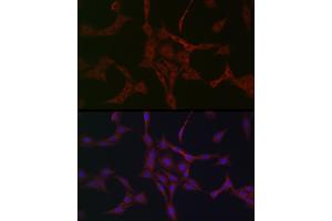 Immunofluorescence analysis of PC-12 cells using NBR1 Rabbit pAb (ABIN1680974, ABIN3018329 and ABIN3018330) at dilution of 1:50 (40x lens). (NBR1 抗体)