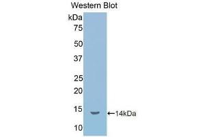 Detection of Recombinant IL1R1, Human using Polyclonal Antibody to Interleukin 1 Receptor Type I (IL1R1) (IL1R1 抗体  (AA 226-318))