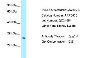 Western Blotting (WB) image for anti-Cysteine-Rich Secretory Protein 3 (CRISP3) (N-Term) antibody (ABIN2789797) (CRISP3 抗体  (N-Term))