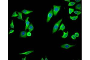 Immunofluorescence staining of HepG2 Cells with ABIN7127435 at 1:50, counter-stained with DAPI. (Recombinant PTGS2 抗体)