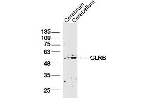 Lane 1: Mouse Cerebrum; Lane 2: Mouse Cerebellum lysates probed with GLRB Polyclonal Antibody, Unconjugated (bs-20450R) at 1:300 overnight at 4˚C. (GLRB 抗体  (AA 51-150))
