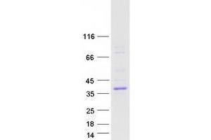 Western Blotting (WB) image for Aspartate beta-Hydroxylase Domain Containing 2 (ASPHD2) protein (Myc-DYKDDDDK Tag) (ABIN2715004)