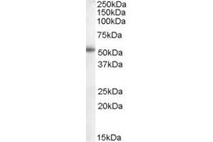 Western Blotting (WB) image for anti-Epithelial Splicing Regulatory Protein 2 (ESRP2) (N-Term) antibody (ABIN2780318) (ESRP2 抗体  (N-Term))