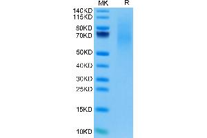 Cynomolgus CD27 Ligand/CD70 on Tris-Bis PAGE under reduced condition. (CD70 Protein (AA 39-194) (His tag))