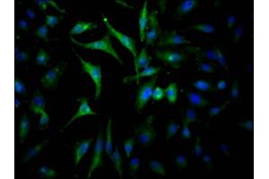 Immunofluorescence staining of Hela Cells with ABIN7127587 at 1:50, counter-stained with DAPI. (Recombinant JAK2 抗体)