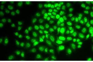 Immunofluorescence analysis of HeLa cells using CCNG1 Polyclonal Antibody (Cyclin G1 抗体)