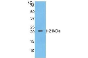 Detection of Recombinant IL17RE, Rat using Polyclonal Antibody to Interleukin 17 Receptor E (IL17RE) (IL17RE 抗体  (AA 457-626))