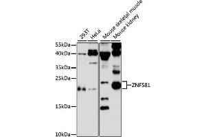 Western blot analysis of extracts of various cell lines, using ZNF581 antibody (ABIN6128960, ABIN6150520, ABIN6150521 and ABIN6217055) at 1:3000 dilution. (ZNF581 抗体  (AA 1-90))