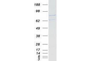 Western Blotting (WB) image for Peroxiredoxin 2 (PRDX2) (Transcript Variant 3) protein (Myc-DYKDDDDK Tag) (ABIN2728699)