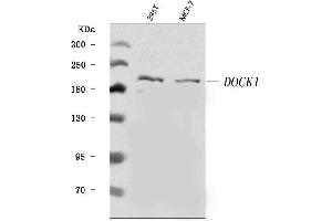 Western blot analysis of DOCK180/DOCK1 using anti-DOCK180/DOCK1 antibody (ABIN7599615).