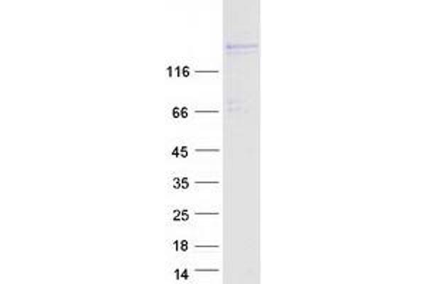 PRDM16 Protein (Transcript Variant 1) (Myc-DYKDDDDK Tag)