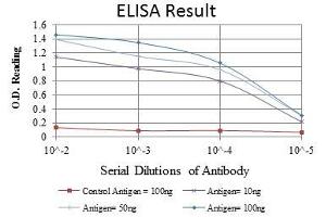 Red: Control Antigen (100 ng), Purple: Antigen (10 ng), Green: Antigen (50 ng), Blue: Antigen (100 ng), (Endoglin 抗体)