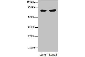 Western blot All lanes: PGM2L1 antibody at 0. (PGM2L1 抗体  (AA 101-400))