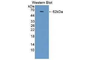 Detection of Recombinant STAR, Human using Polyclonal Antibody to Steroidogenic Acute Regulatory Protein (STAR) (STAR 抗体  (AA 1-285))
