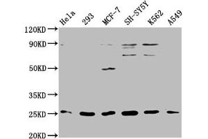 Western Blot Positive WB detected in: Hela whole cell lysate, 293 whole cell lysate, MCF-7 whole cell lysate, SH-SY5Y whole cell lysate, K562 whole cell lysate, A549 whole cell lysate All lanes: ARHGDIG antibody at 1:2000 Secondary Goat polyclonal to rabbit IgG at 1/50000 dilution Predicted band size: 26 kDa Observed band size: 26 kDa (ARHGDIG 抗体  (AA 1-225))