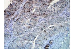 Immunohistochemistry analysis using Mouse Anti-Hsp90 Monoclonal Antibody, Clone D7alpha (ABIN361792 and ABIN361793). (HSP90 抗体)