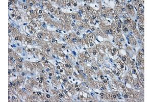 Immunohistochemical staining of paraffin-embedded pancreas tissue using anti-AKR1A1mouse monoclonal antibody. (AKR1A1 抗体)
