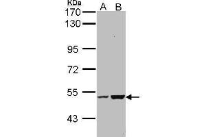 WB Image Sample (30 ug of whole cell lysate) A: Molt-4 , B: Raji 7. (KIAA0494 抗体  (Center))