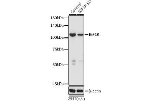 Western blot analysis of extracts of 293T cells, using IGF1R antibody (ABIN3020767, ABIN3020768, ABIN3020769 and ABIN6213714) at 1:3000 dilution. (IGF1R 抗体  (AA 660-760))