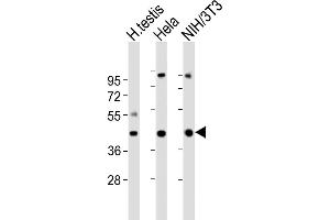 All lanes : Anti-GNA11 Antibody (Center) at 1:2000 dilution Lane 1: human testis lysates Lane 2: Hela whole cell lysates Lane 3: NIH/3T3 whole cell lysates Lysates/proteins at 20 μg per lane. (GNA11 抗体  (AA 115-146))