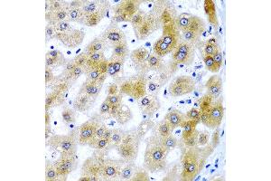 Immunohistochemistry of paraffin-embedded human liver injury using SECISBP2 antibody at dilution of 1:200 (40x lens). (SECISBP2 抗体)