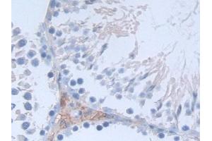 Detection of SDC1 in Rat Testis Tissue using Polyclonal Antibody to Syndecan 1 (SDC1) (Syndecan 1 抗体  (AA 58-313))