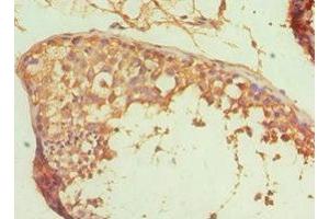 Immunohistochemistry of paraffin-embedded human testis tissue using ABIN7167765 at dilution of 1:100 (ALDH1A1 抗体  (AA 202-501))