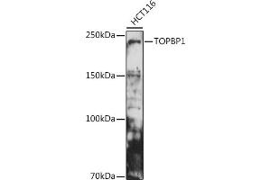 Western blot analysis of extracts of HCT116 cells, using TOPBP1 antibody (ABIN6129493, ABIN6149398, ABIN6149401 and ABIN6221465) at 1:500 dilution. (TOPBP1 抗体  (AA 1253-1522))