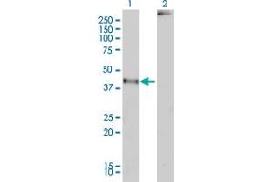 Western Blot analysis of MAGEA2 expression in transfected 293T cell line by MAGEA2 monoclonal antibody (M01), clone 1H4. (MAGEA2 抗体  (AA 1-314))
