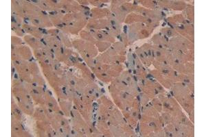 DAB staining on IHC-P; Samples: Mouse Heart Tissue (ATP2B2 抗体  (AA 417-830))
