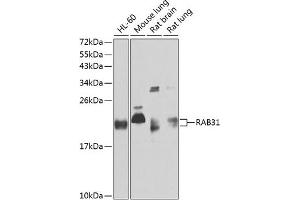 Western blot analysis of extracts of various cell lines, using R antibody (ABIN6128595, ABIN6146569, ABIN6146571 and ABIN6220321) at 1:1000 dilution. (RAB31 抗体  (AA 1-195))