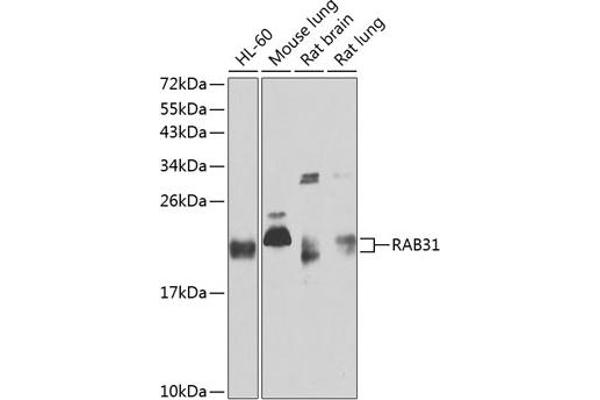 RAB31 抗体  (AA 1-195)