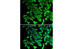 Immunofluorescence analysis of A549 cells using PTGES2 antibody. (PTGES2 抗体)